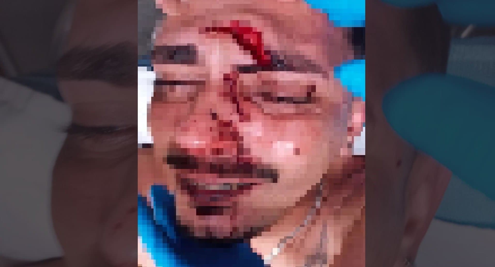 Jovem é atingido por garrafada na cabeça durante a Fejuna e acaba hospitalizado em Nova Andradina